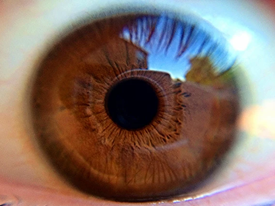 ¿Qué parte del ojo puede trasplantarse?